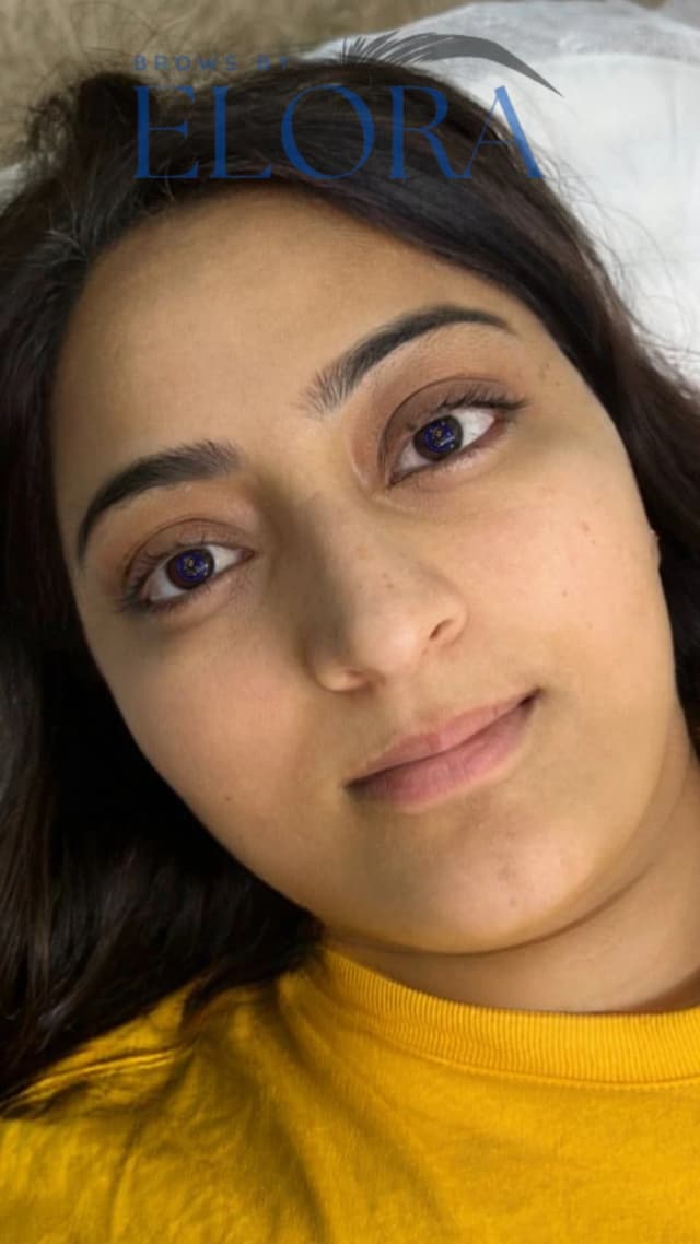second image