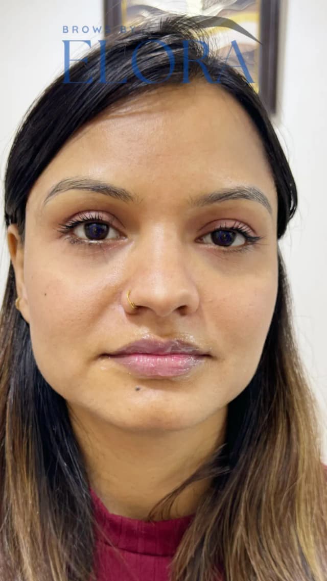 second image