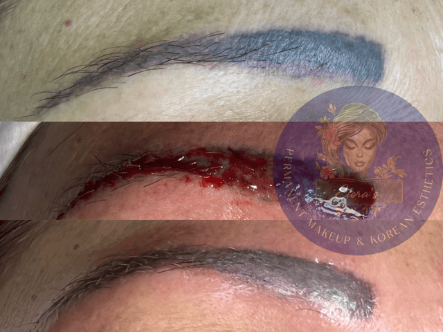 Advanced-hydra-facial-treatment