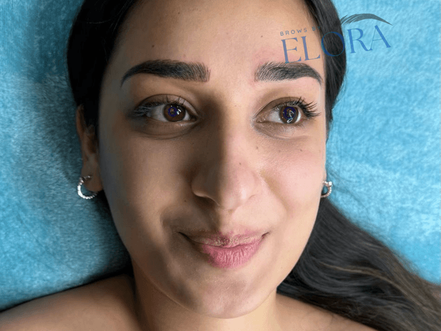 Nano Blading creating fine, natural hair strokes for fuller eyebrows