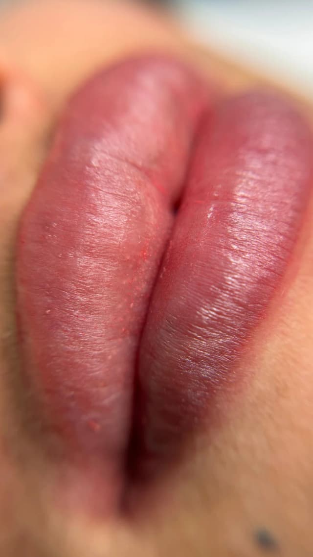second image