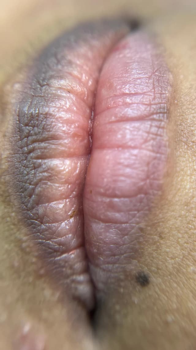 first image