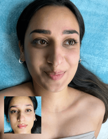 Comparison of Combination brows 