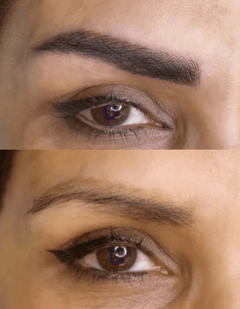 Eyebrows Correction
