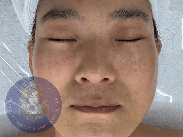 Elora PMU Treatmet Service