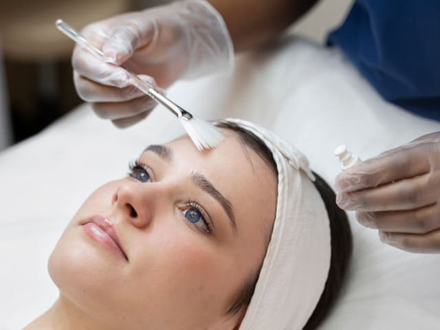 Glycolic Acid Peel Image
