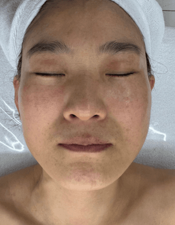 Korean Facial