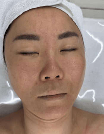 Korean Facial