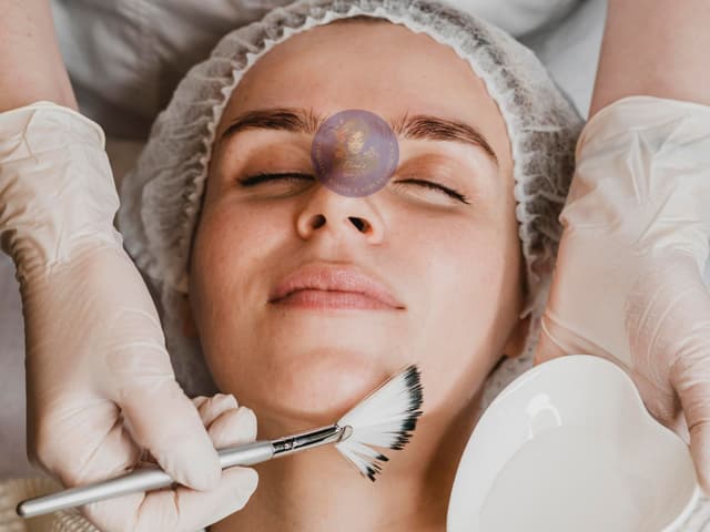 Salicylic Acid Peel Treatment Image