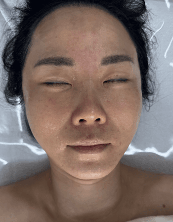 Korean Facial