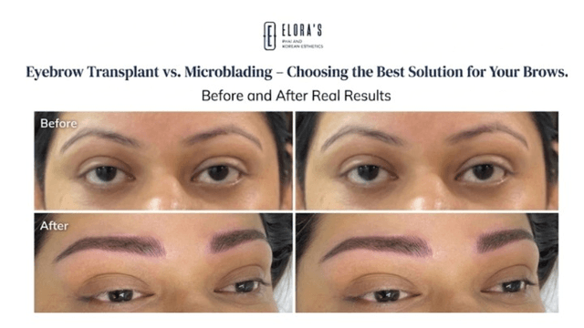 microblading in pune  eyebrow studio near me (Delhi) microblading in chandigarh  brow shaping near me  microblading eyebrows before and after what is microblading eyebrows eyebrow tattoo cost